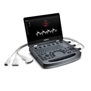 Mindray Portable USG (MX6) – Ultrasound | Sysmark Bangladesh
