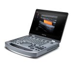 Mindray Portable USG (MX3) – Ultrasound | Sysmark Bangladesh